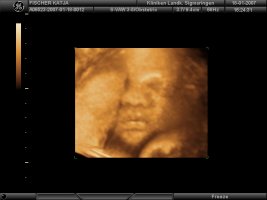 BABY 3D_12.jpg