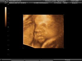 BABY 3D_17.jpg