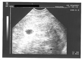 Krümel 2 6te Wo.jpg