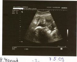 Baby Bild 3.jpg