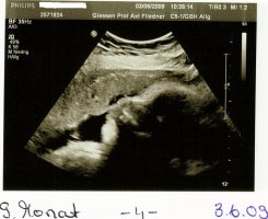 Baby Bild 4.jpg