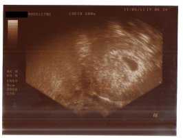 Madeleine ultraschall 11.05.jpg